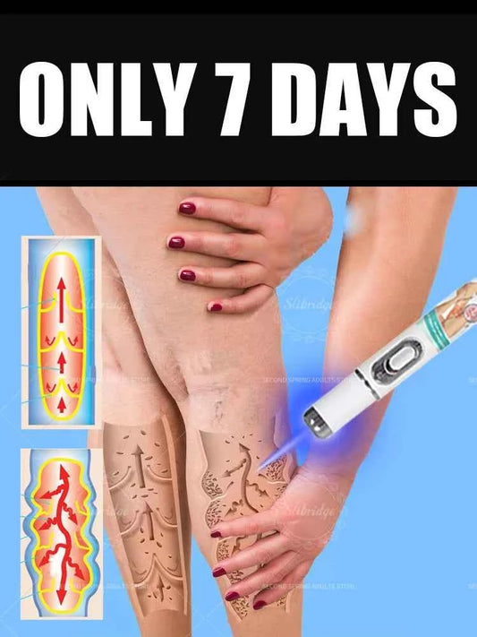 Vein blue light tool Combination Set. Says Goodbye To Spider Legs