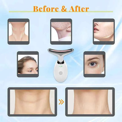 DFShop Skin Tightening Beauty Device with Color Therapy - DFShop